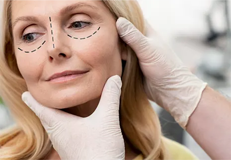 بلفاروپلاستی