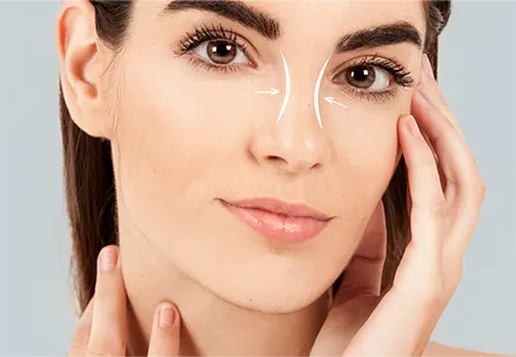 رینوپلاستی