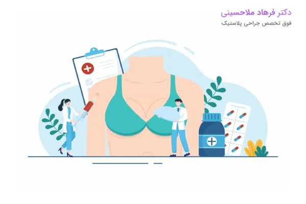 مزایای ماموپلاستی