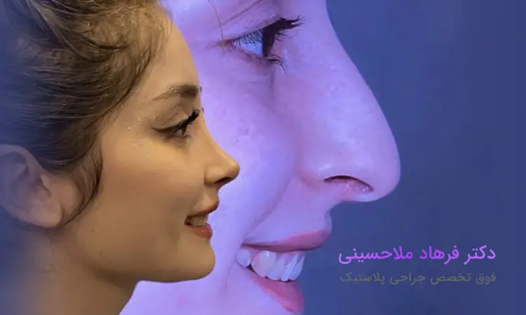 جراح در جراحی بینی فانتزی در بندرعباس چه کارهایی را انجام میدهد؟
