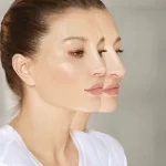 هزینه عمل بینی