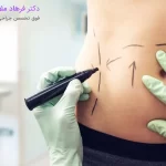 هزینه پیکرتراشی