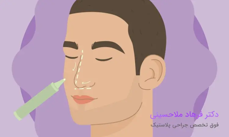 مزایای عمل بینی مردانه