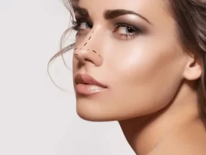 انواع جراحی بینی