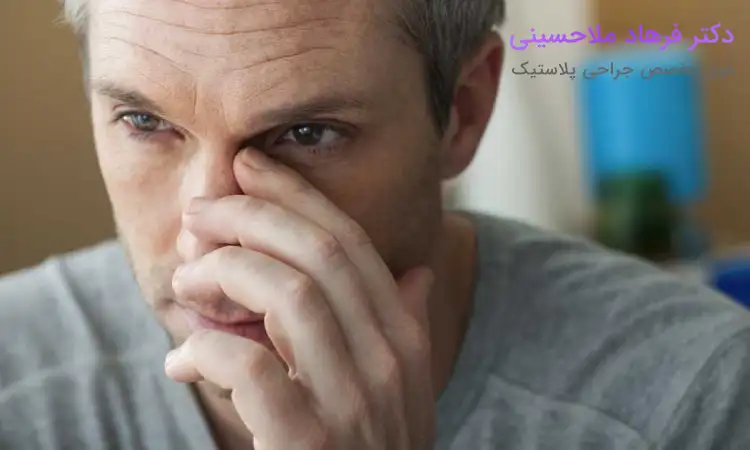 انحراف بینی چیست؟