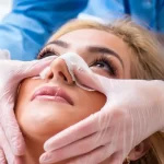 ماساژ بینی بعد از عمل