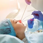 عمل بینی با لیزر