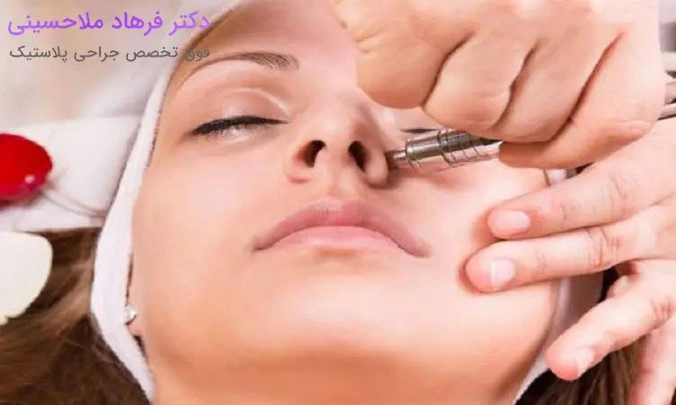 عمل بینی با لیزر چیست؟