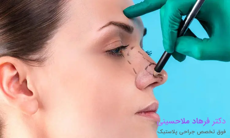 نکات مراقبتی در مورد عمل بینی با لیزر