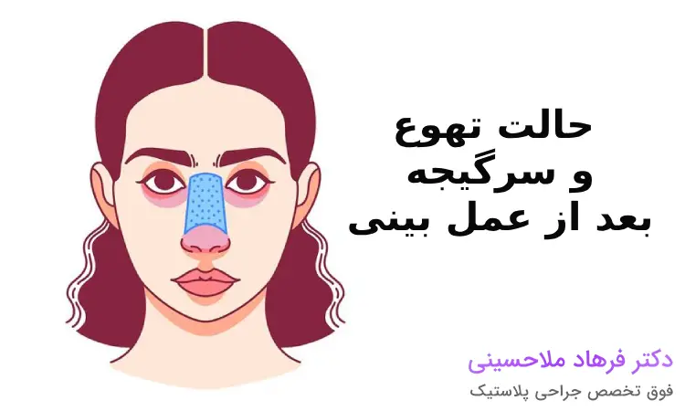 داروهایی که سرگیجه و حالت تهوع بعد از عمل بینی را کاهش می‌دهند