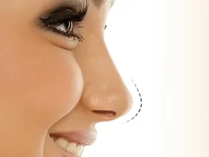 سفت شدن نوک بینی بعد از عمل