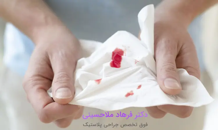 پیشگیری از خونریزی بعد از عمل بینی