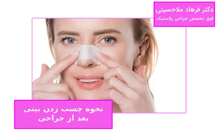 نحوه چسب زدن بینی بعد از جراحی