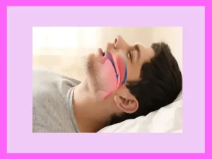 مشکلات تنفسی بعد از جراحی بینی