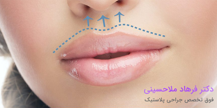 علت بی‌حسی لب بعد از عمل بینی چیست؟