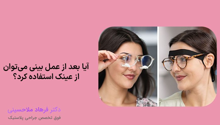 آیا بعد از عمل بینی می‌توان از عینک استفاده کرد؟