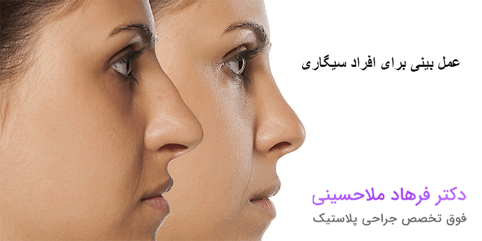 تاثیر سیگار بر نتایج عمل بینی