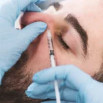 تزریق کورتون به بینی