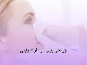جراحی بینی در افراد یابتی