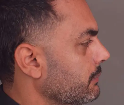 بعد