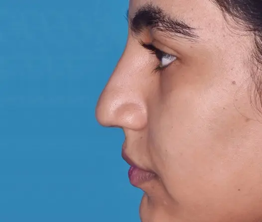 روی تصویر کلیک کنید
