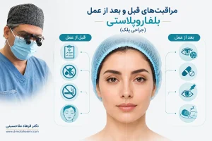 مراقبت‌های قبل و بعد از عمل بلفاروپلاستی (جراحی پلک) | دکتر جراحی پلک در بندرعباس