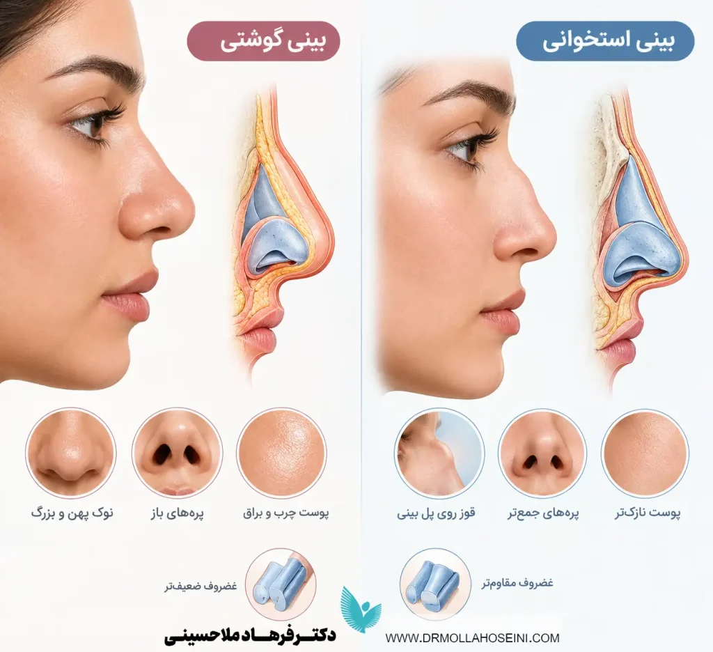 تفاوت بینی استخوانی و گوشتی | جراحی بینی در بندرعباس