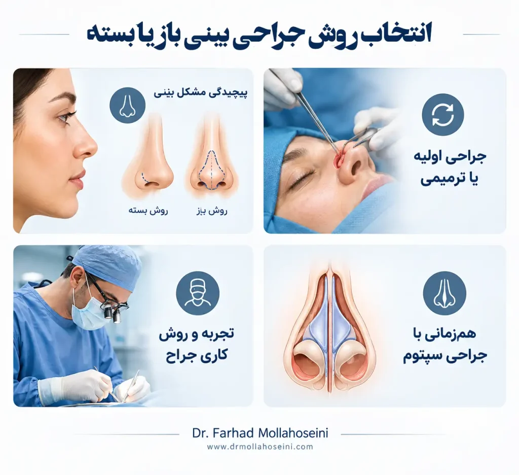 انتخاب بین جراحی بینی باز و بسته |بهترین دکتر بینی در بندرعباس
