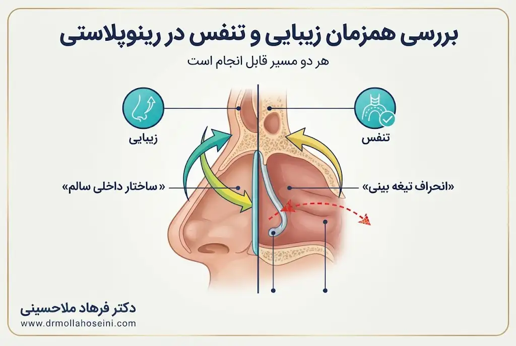 نظر و تجربه دکتر ملاحسینی درباره انتخاب روش مناسب جراحی بینی 