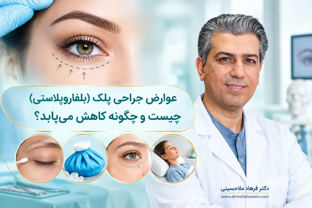 عوارض بعد از بلفاروپلاستی | دکتر فرهاد ملاحسینی