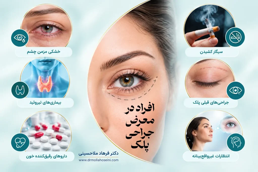چه افرادی بیشتر در معرض عوارض جراحی پلک هستند؟ | بهترین جراح پلک بندرعباس