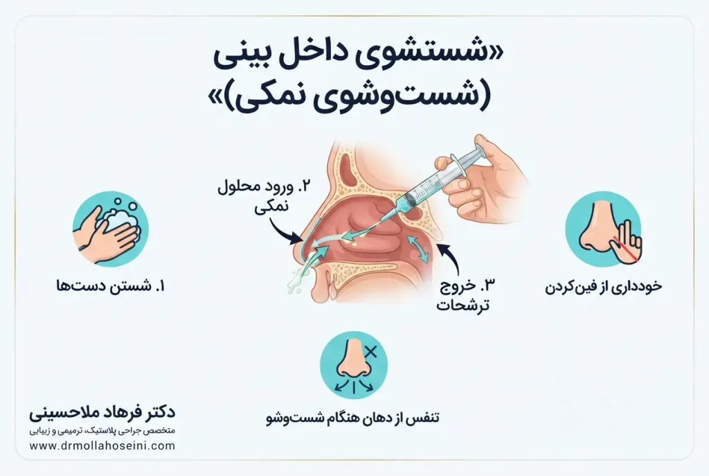 شستشوی داخل بینی بعد از عمل جراحی | دکتر فرهاد ملاحسینی