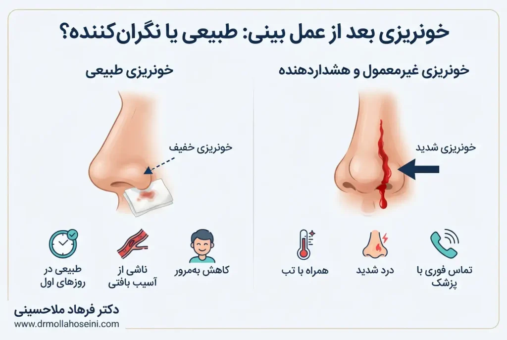 خونریزی بعد از عمل بینی | بهترین جراح بینی در بندرعباس