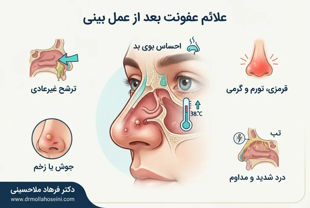 نشانه های عفونت بعد از عمل بینی | دکتر فرهاد ملاحسینی