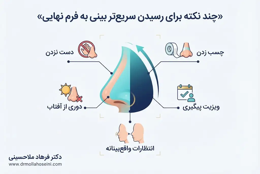 نکات لازم برای رسیدن سریع‌تر بینی به فرم نهایی