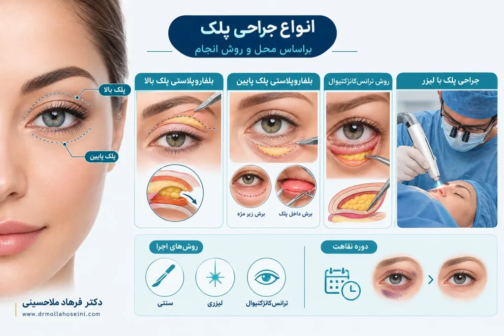 انواع جراحی پلک بر اساس محل و روش انجام