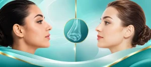 عمل بینی گوشتی یا استخوانی؛ کدام مناسب شماست؟ کلینیک فوق تخصص زیبایی دکتر فرهاد ملاحسینی