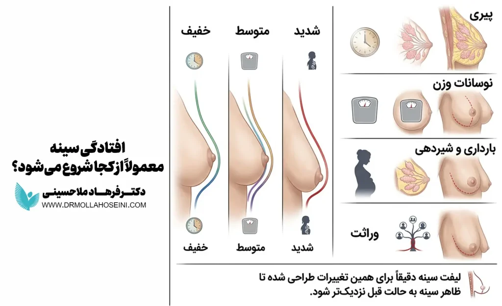 انواع افتادگی سینه | دکتر فرهاد ملاحسینی