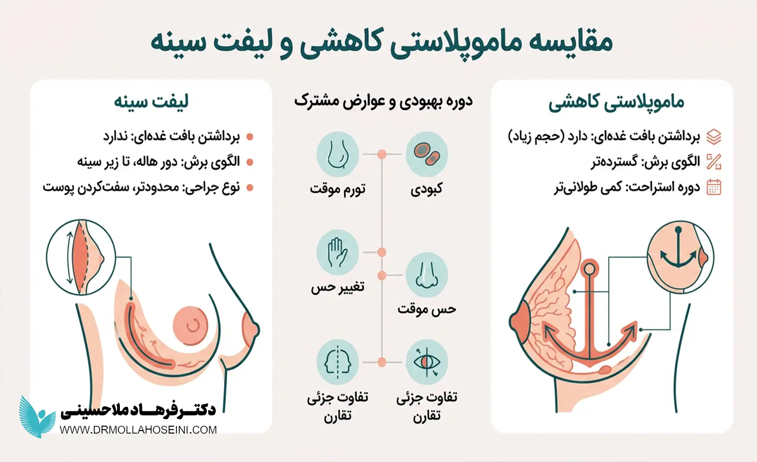 تفاوت لیفت سینه با ماموپلاستی کاهشی