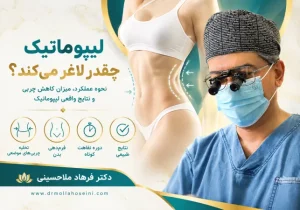 لیپوماتیک | دکتر فرهاد ملاحسینی