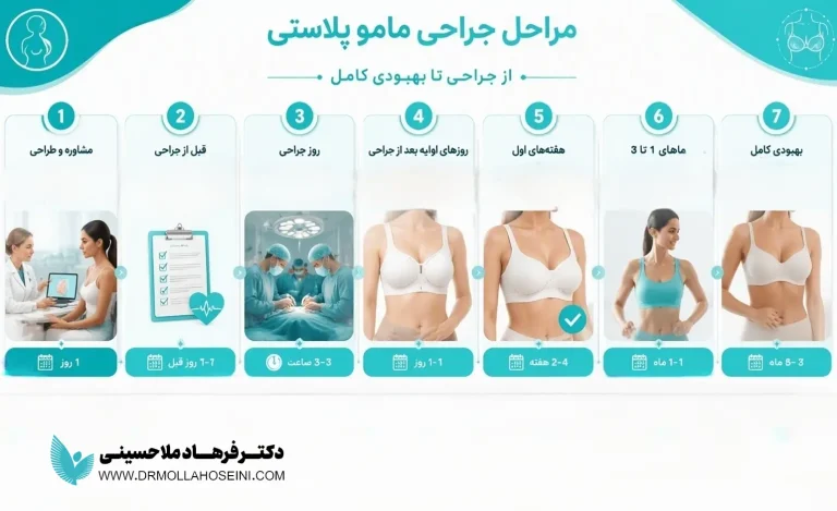 مراحل انجام عمل کوچک کردن سینه، گام به گام | دکتر فرهاد ملاحسینی