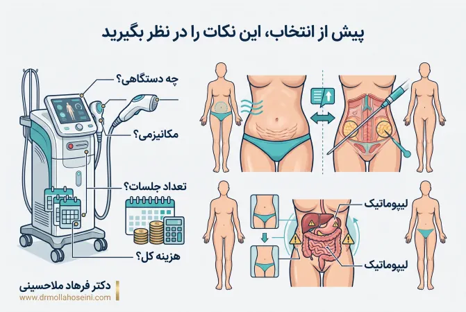 نکات لازم قبل از پیکر تراشی | بهترین دکتر پزشک پیکرتراشی در بندرعباس