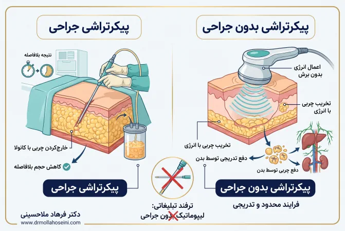 پیکرتراشی بدون جراحی | دکتر فرهاد ملاحسینی