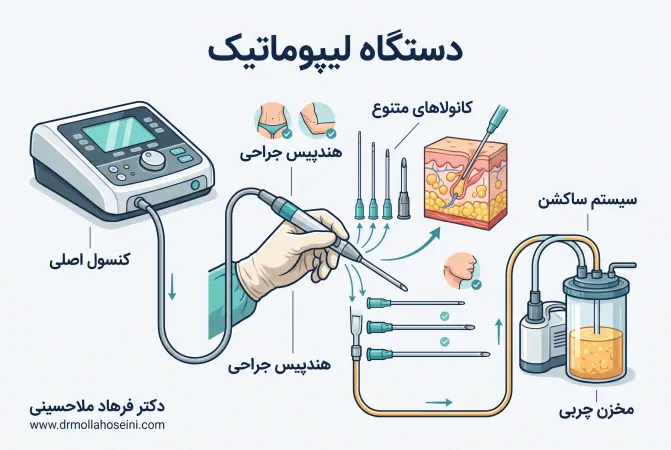 اجزای دستگاه لیپوماتیک | دکتر فرهاد ملاحسینی