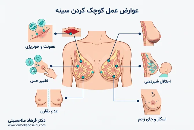 عوارض کوچک کردن سینه | دکتر فرهاد ملاحسینی