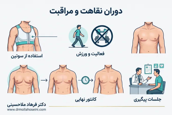 مراقبت‌های بعد از ژنیکوماستی