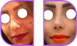 نمونه کار دکتر ملاحسینی