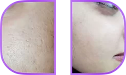 نمونه کار دکتر ملاحسینی